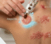 Skin Infections / Dermatitis